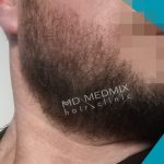 zagęszczanie brody i zarostu